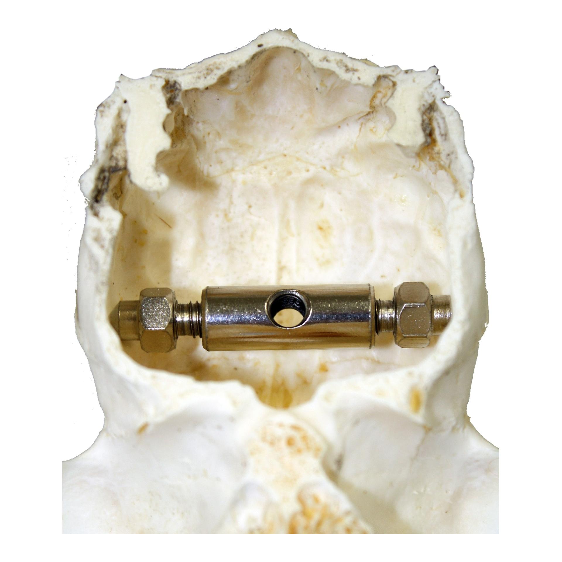 Trophäenhalterung Rehbock